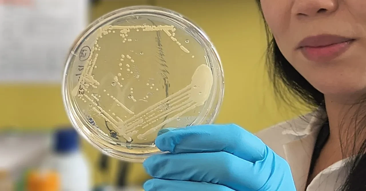 Vücudu kendi kendine alkol üretmeye başladı, kimseyi inandıramadı: Sağlığına dışkı nakliyle kavuştu