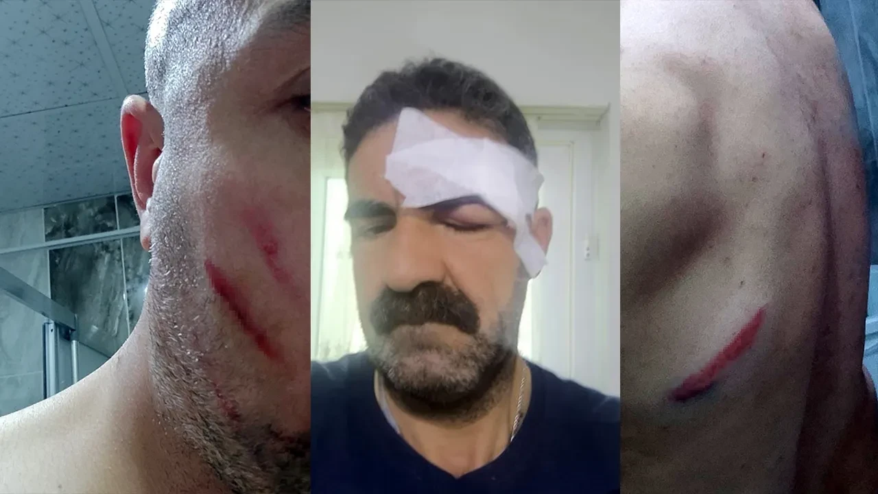 Demir çubuklu kavganın sebebi belli oldu! Meğer duvara tuvaletini yapmış