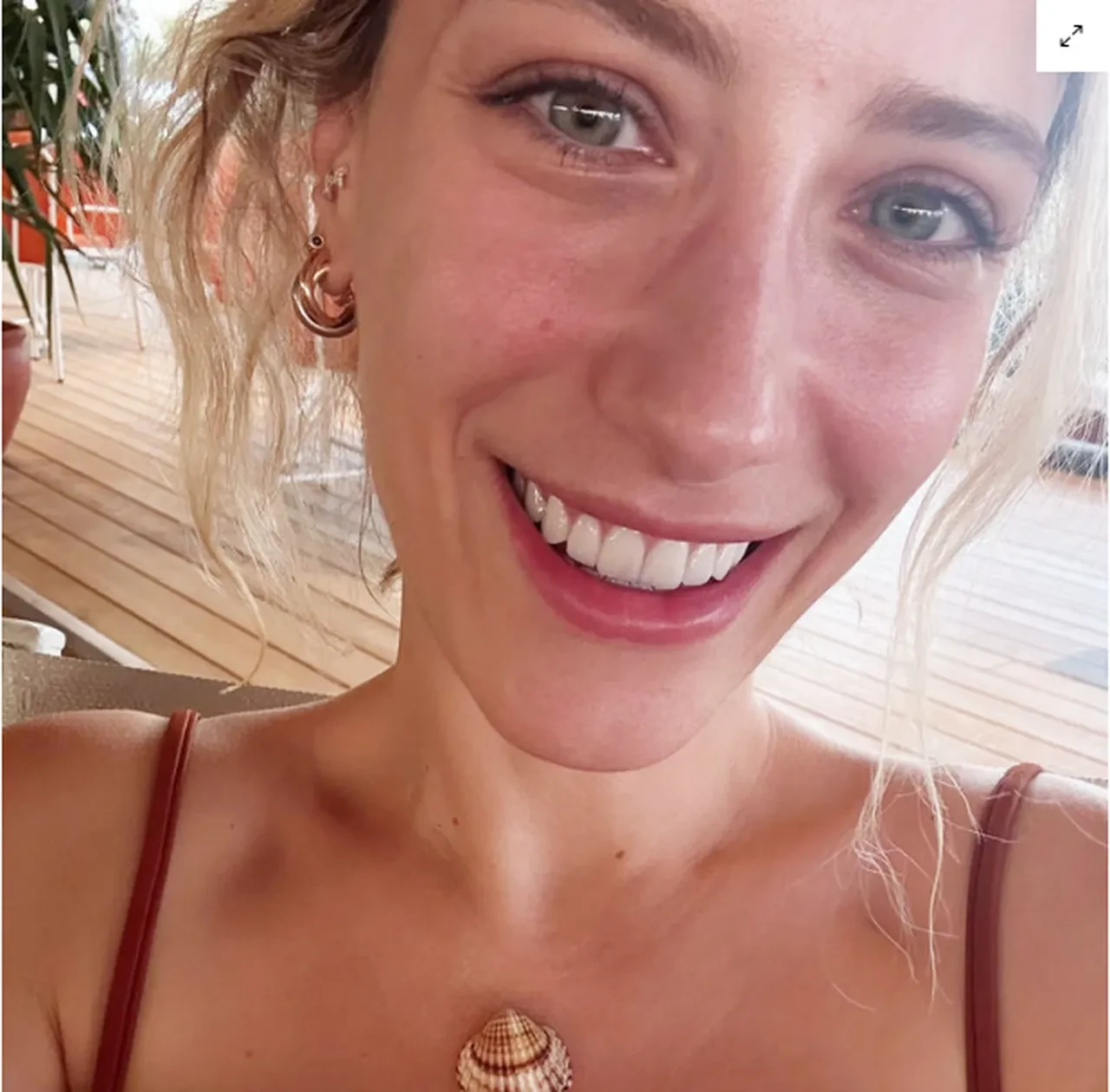 Hazal Kaya eleştiri yağmuruna tutulan diş estetiği açıklaması: Söktürüp yaptırdım 