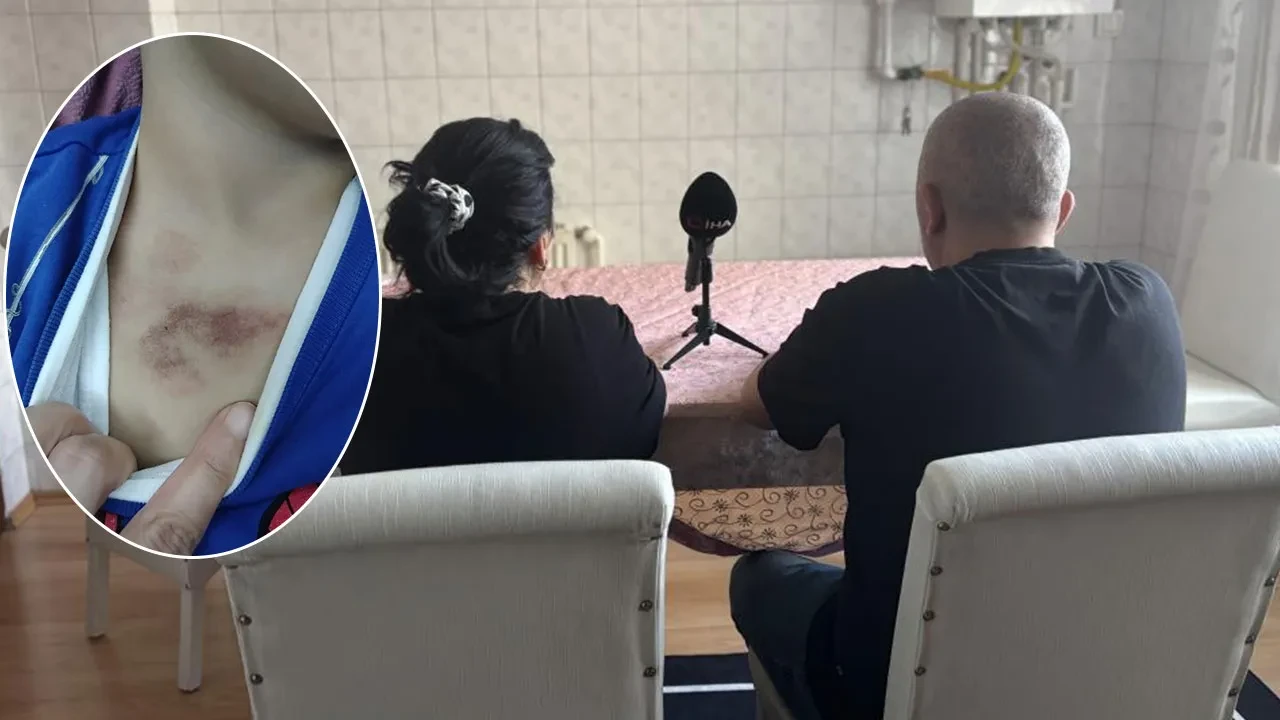 İBB kreşinde şiddet ve istismar skandalı! 3 yaşındaki çocuk eve morluklarla geldi aile suç duyurusunda bulundu