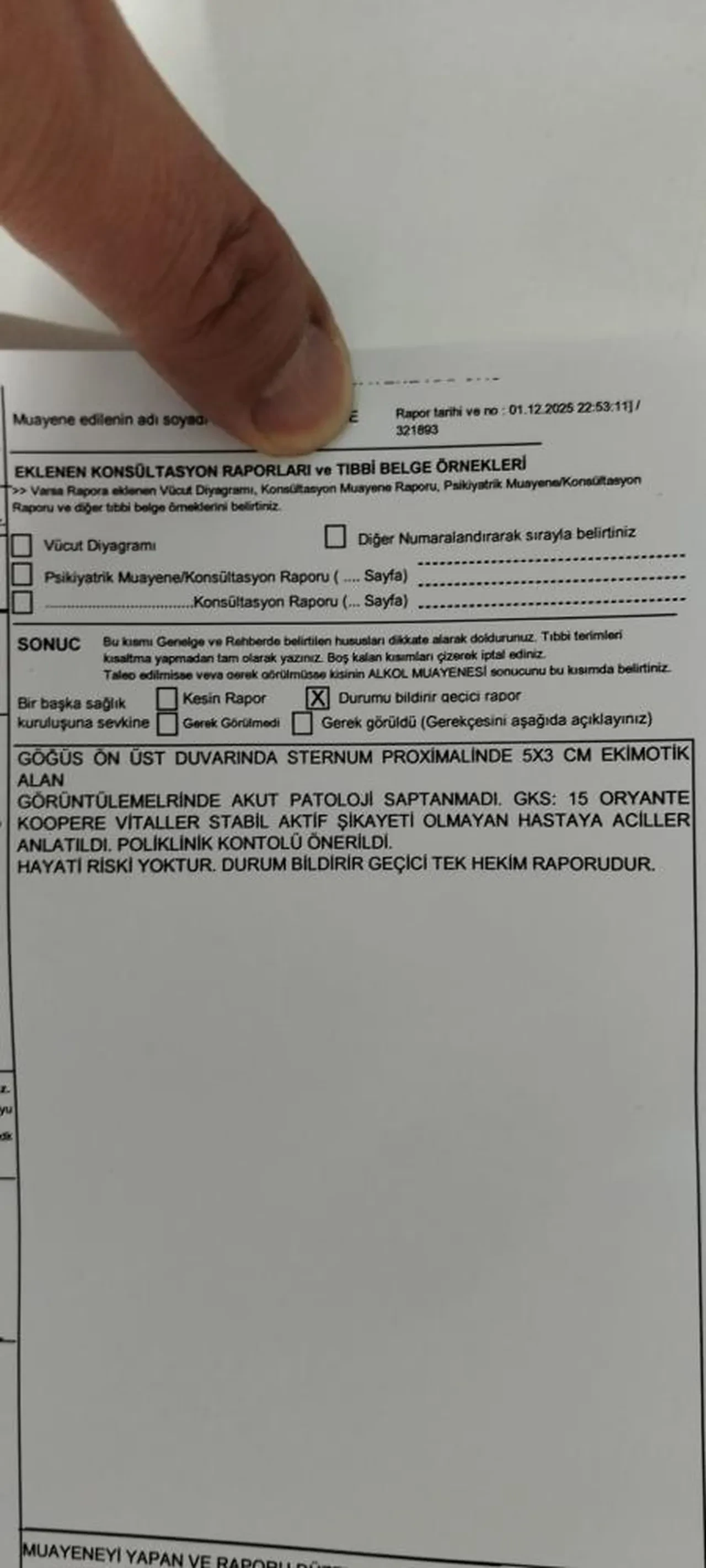 İBB kreşinde şiddet ve istismar skandalı! 3 yaşındaki çocuk eve morluklarla geldi aile suç duyurusunda bulundu