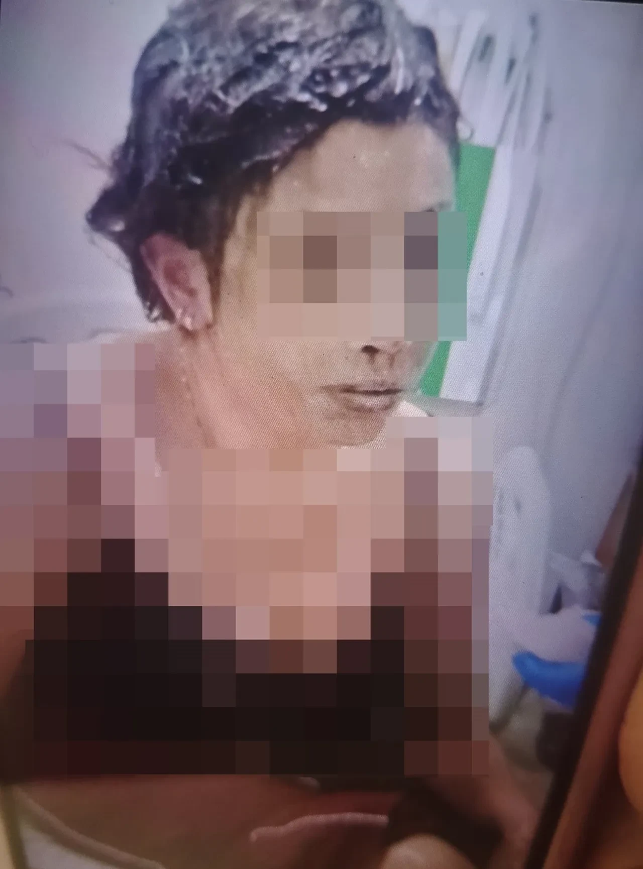 Gaziantep'te vahşet! Eski eşini bağlayıp başından aşağı kezzap döktü: 'Kızımı kör etmiş, mahvetmiş'