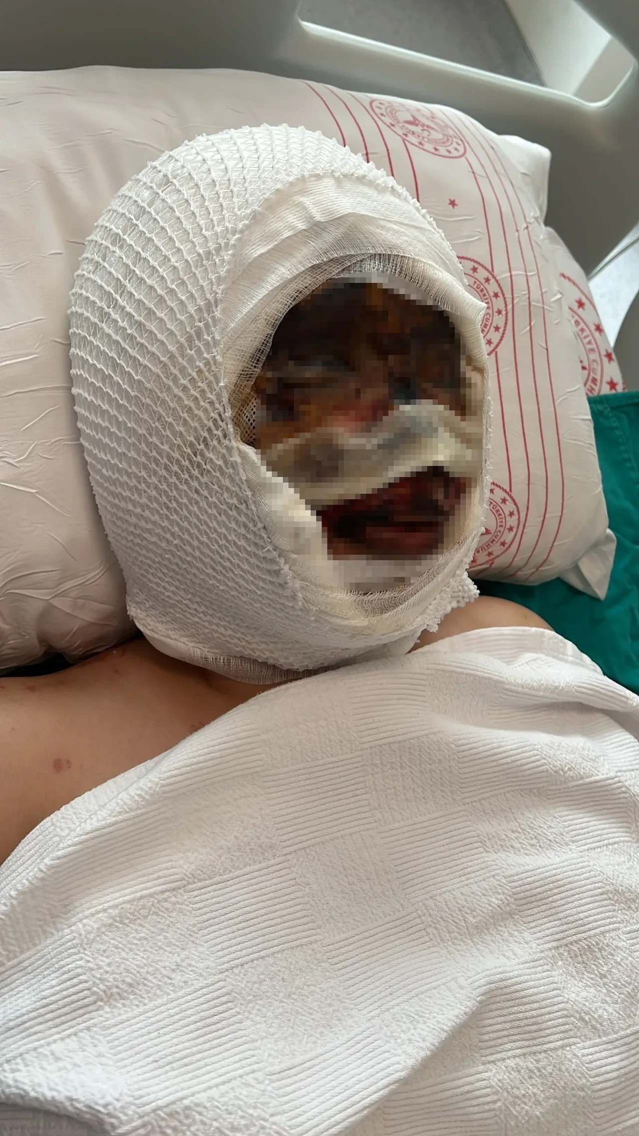 Gaziantep'te vahşet! Eski eşini bağlayıp başından aşağı kezzap döktü: 'Kızımı kör etmiş, mahvetmiş'