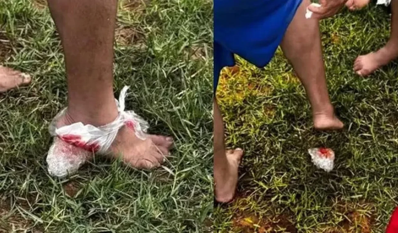 Strese giren piranalar insanlara saldırdı: En az 10 kişi yaralandı