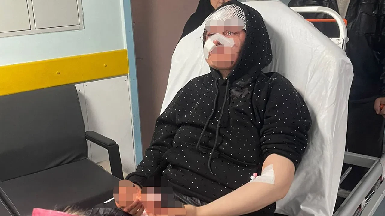 Boşanmak isteyen kadına öldüresiye darp! Taşla saldıran cani koca adliyede