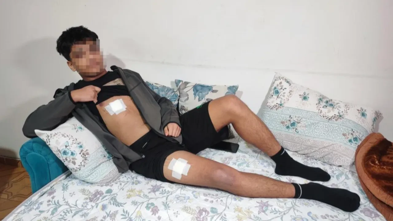 Akran zorbalığı bitmiyor! 15 yaşındaki çocuklar dehşet saçtı: Önce dövdüler sonra bıçakladılar