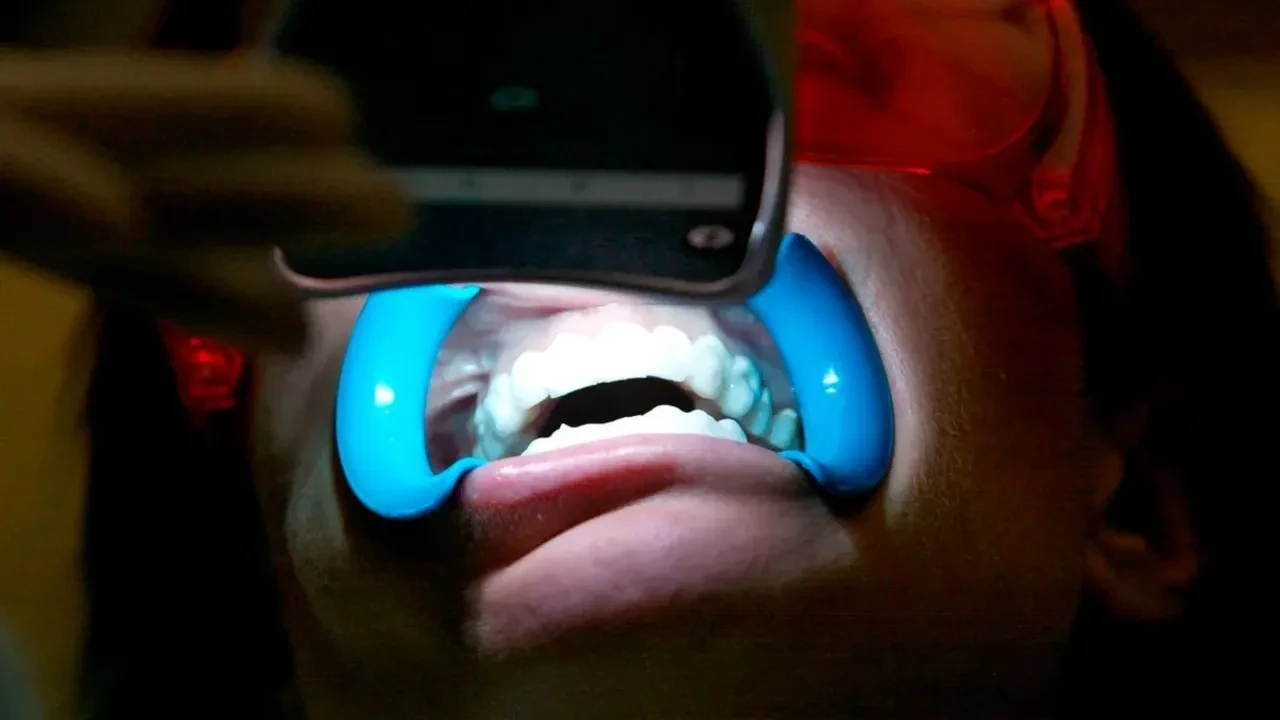 Evde diş beyazlatmak artık çok kolay olacak! 12 saatte etkisini gösteren yöntem geliştirildi