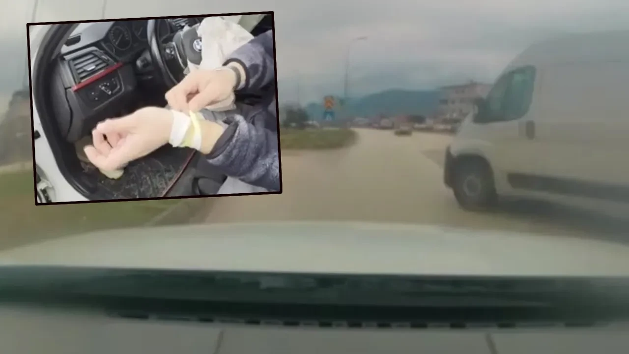 Lüks aracın patlayan airbagı sürücünün elini yaktı