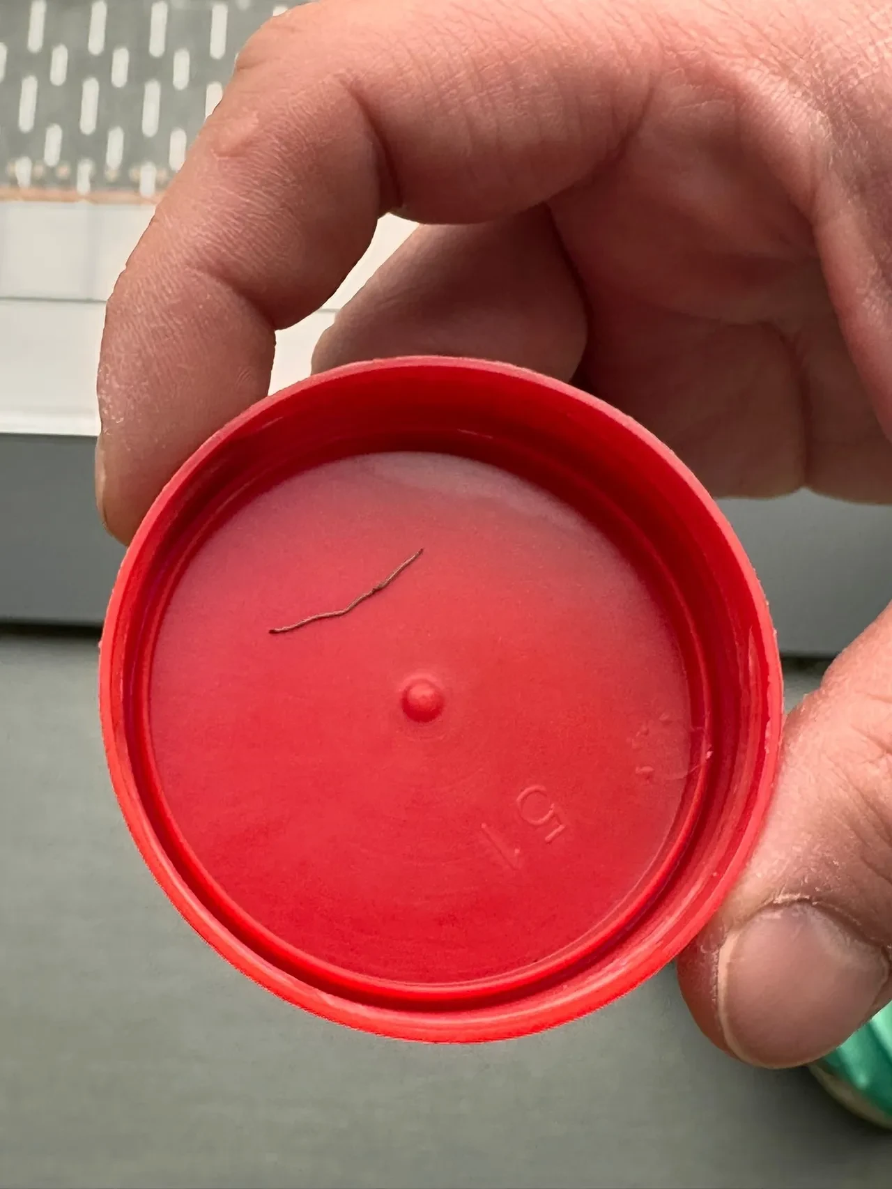 Bebeğin sırtından çıkan cisim şok etti! Gerçek hastanede ortaya çıktı