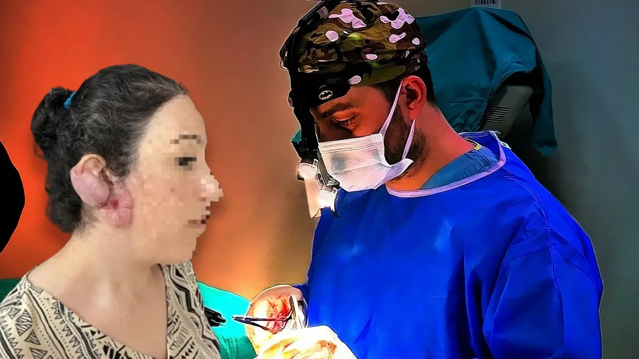 Çocukken delinen kulağı kabusu oldu! Genç kadın yıllar sonra ödüllü teknikle sağlığına kavuşabildi