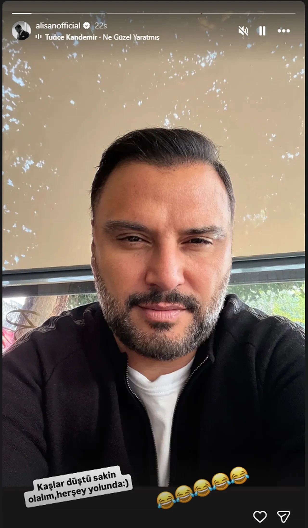 Alişan’dan “botoks yaptırdı” iddialarına fotoğraflı cevap geldi 