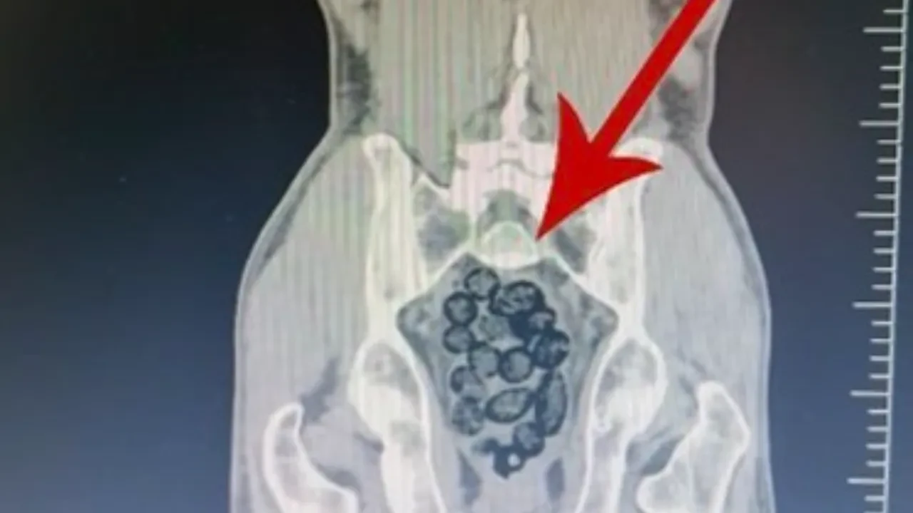 Mide değil, uyuşturucu kapsülü! Şüpheli tavırları ele verdi: Tam 64 parça uyuşturucu midesinden çıktı