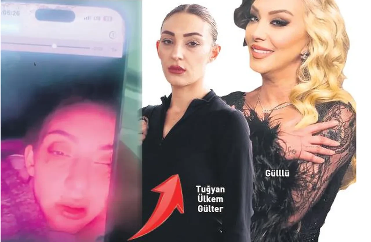 Tuğyan Ülkem Gülter "Annem yaptı" dedi! Darp edilmiş haldeki görüntüsünün altındaki gerçek tüyler ürpertti
