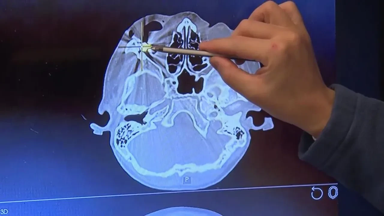 Oynadığı silah ateş aldı, mermi gözüne girip beynine saplandı