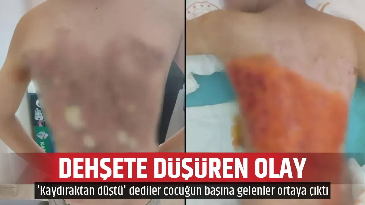 DEHŞETE DÜŞÜREN OLAY