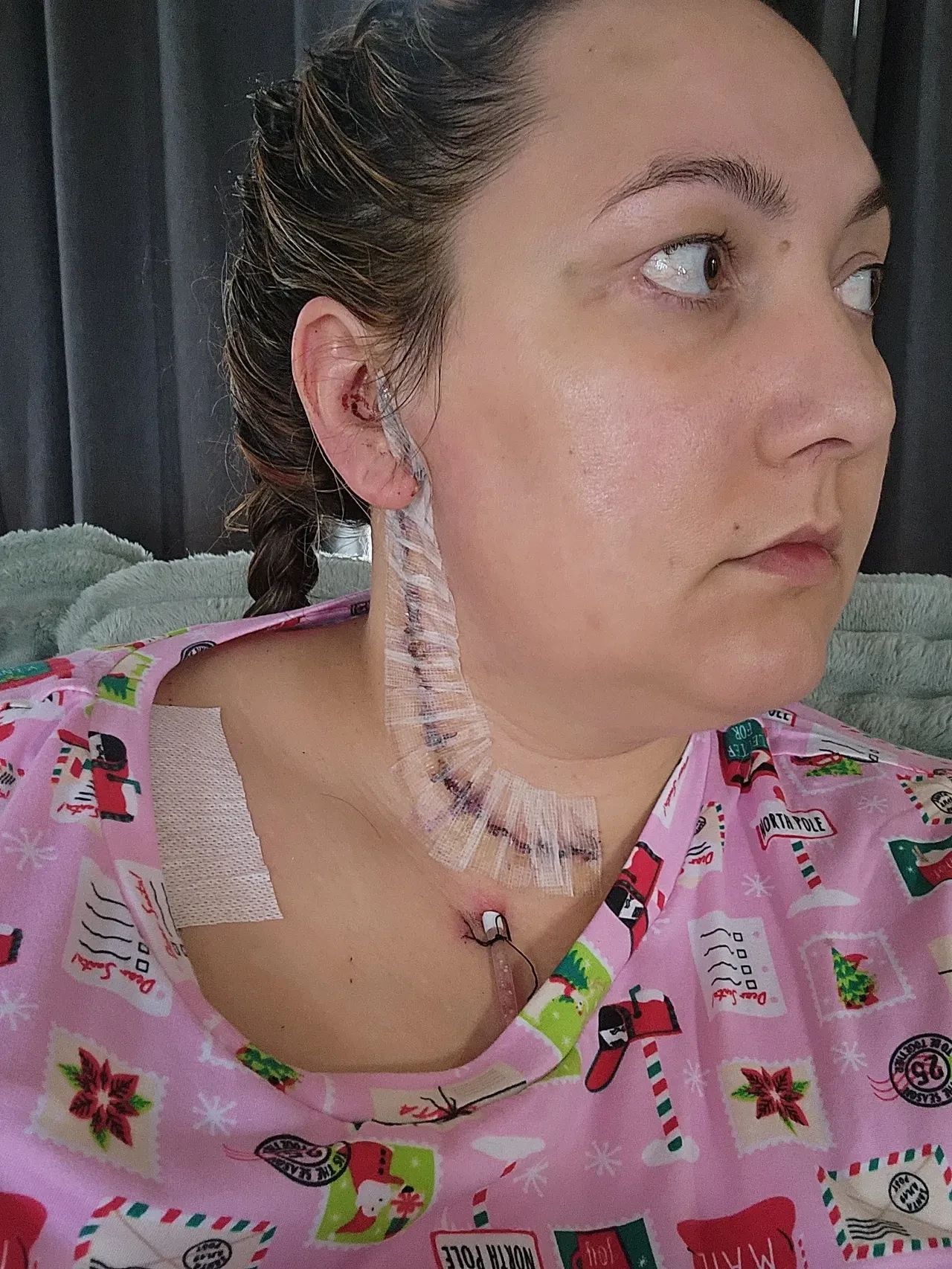 Göz kapağındaki şişlik için doktora gitti, hayatının en zor sürecine girdi: Kanseri yendi ama ağır hasarlarla yaşıyor