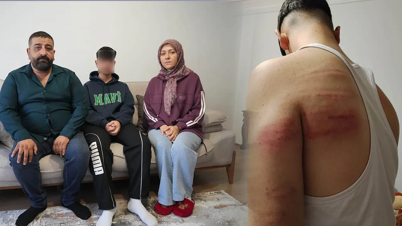 Niğde’de 15 yaşındaki çırağa demir sopalı darp: Önce dövdü, sonra temizlik yaptırdı