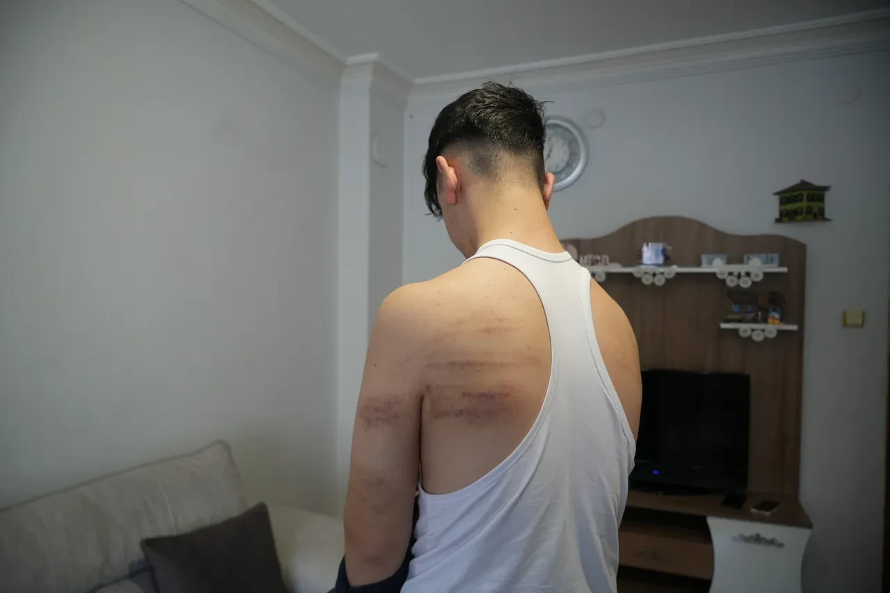 Niğde’de 15 yaşındaki çırağa demir sopalı darp: Önce dövdü, sonra temizlik yaptırdı