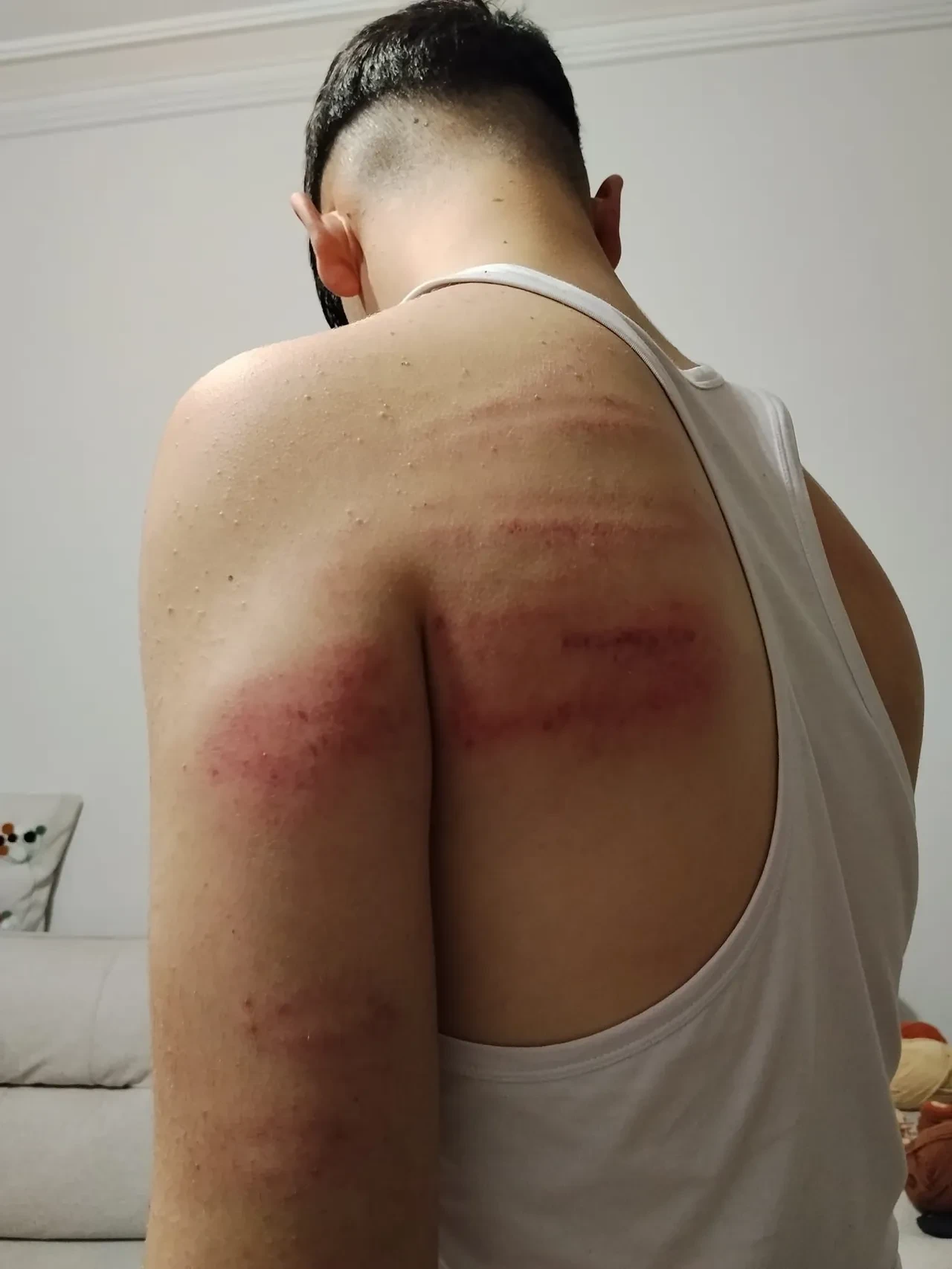 Niğde’de 15 yaşındaki çırağa demir sopalı darp: Önce dövdü, sonra temizlik yaptırdı