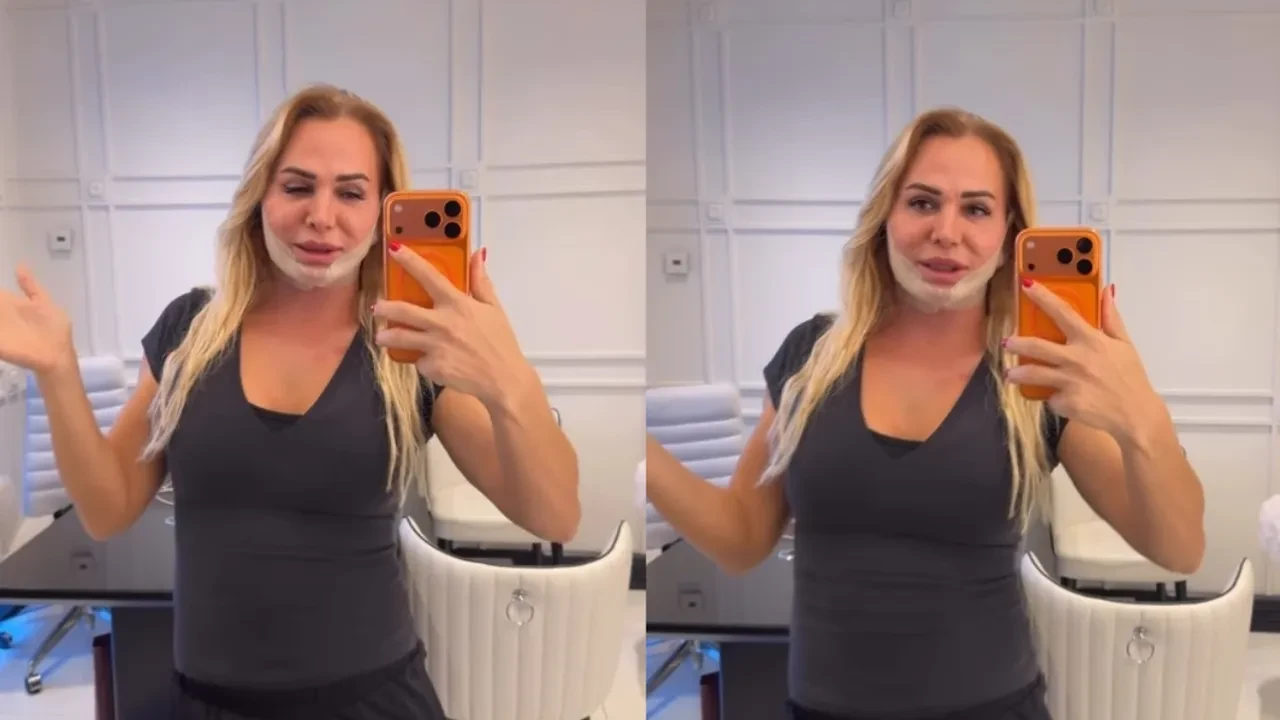 Survivor Nagihan Karadere Barbie bebek olma yolunda! Estetik operasyonları say say bitmedi