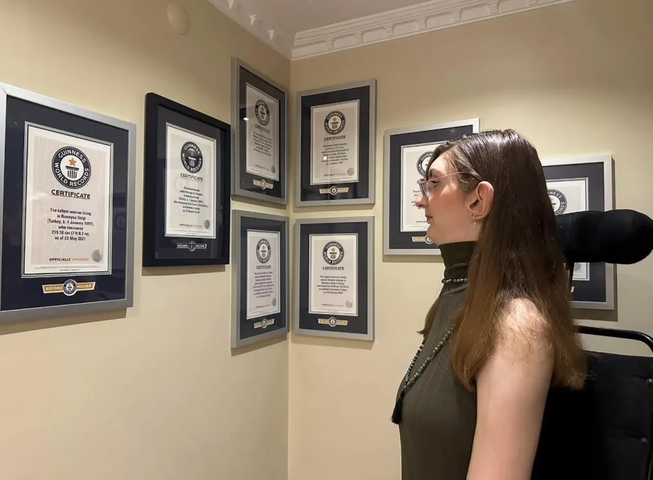 12 yılda 8 kez Guinness Rekorlar Kitabı'na girdi: Dünyanın en uzun kadını Rumeysa Gelgi tıp literatürüne ışık tutuyor