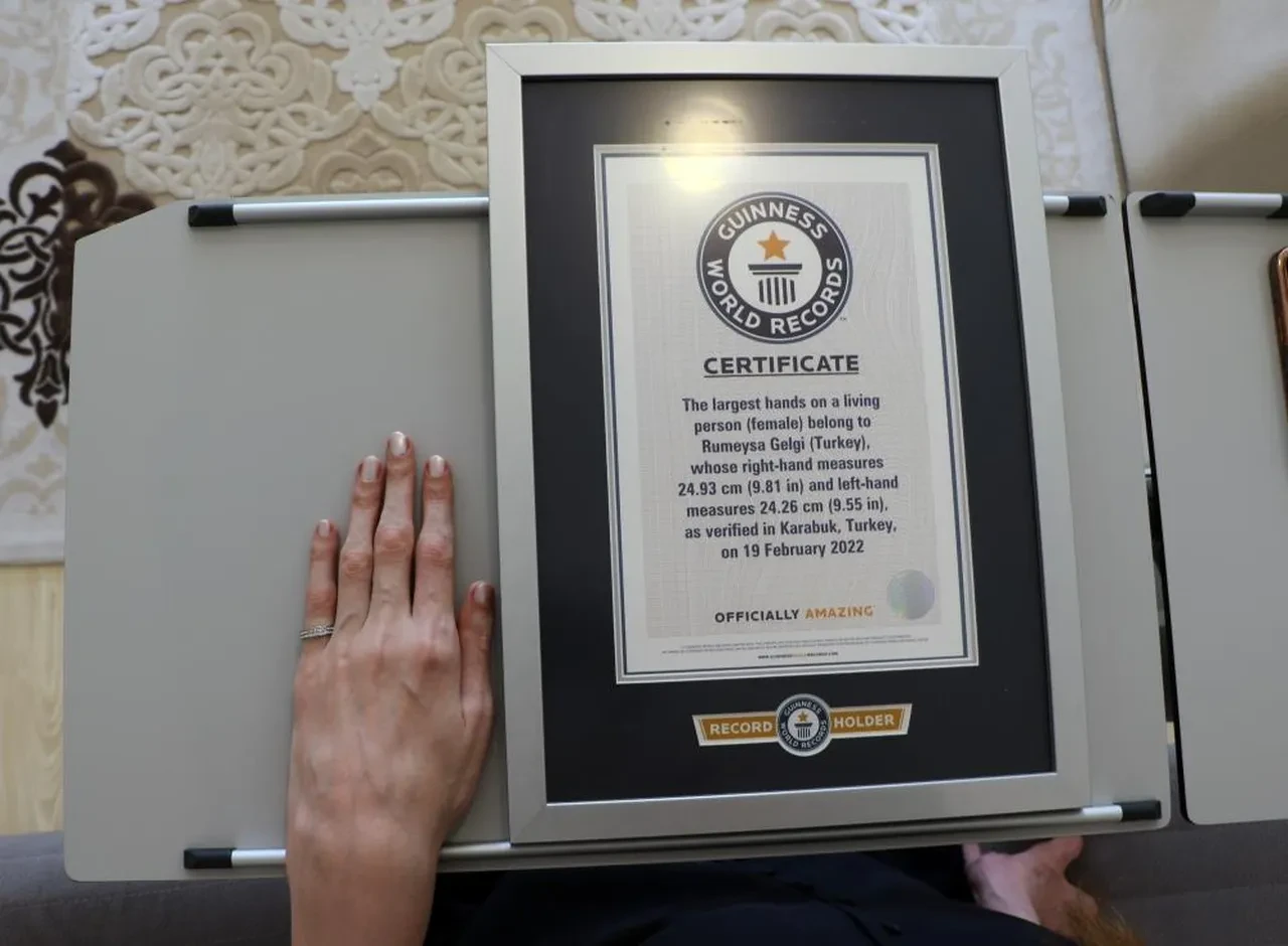 12 yılda 8 kez Guinness Rekorlar Kitabı'na girdi: Dünyanın en uzun kadını Rumeysa Gelgi tıp literatürüne ışık tutuyor
