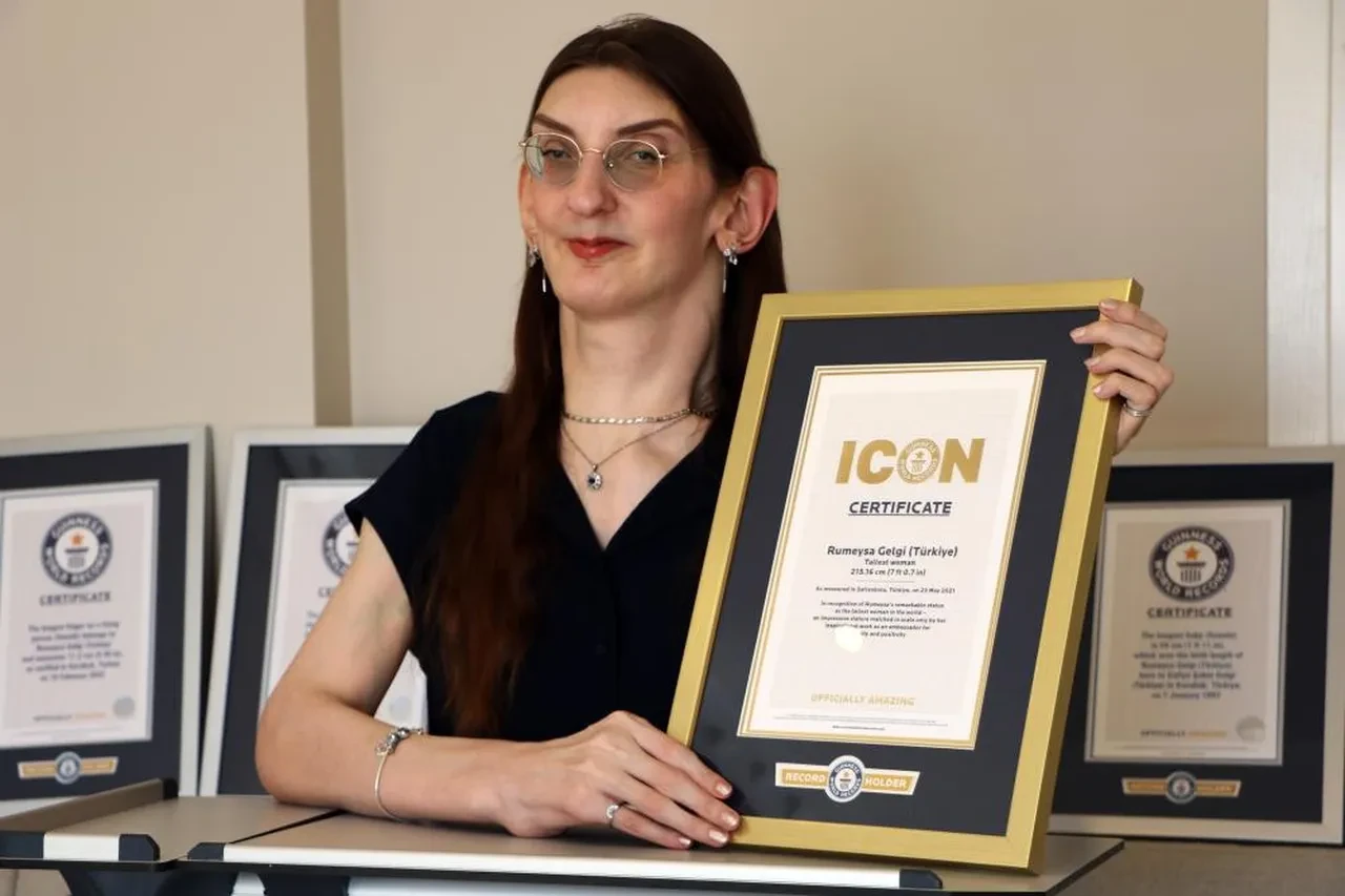 12 yılda 8 kez Guinness Rekorlar Kitabı'na girdi: Dünyanın en uzun kadını Rumeysa Gelgi tıp literatürüne ışık tutuyor