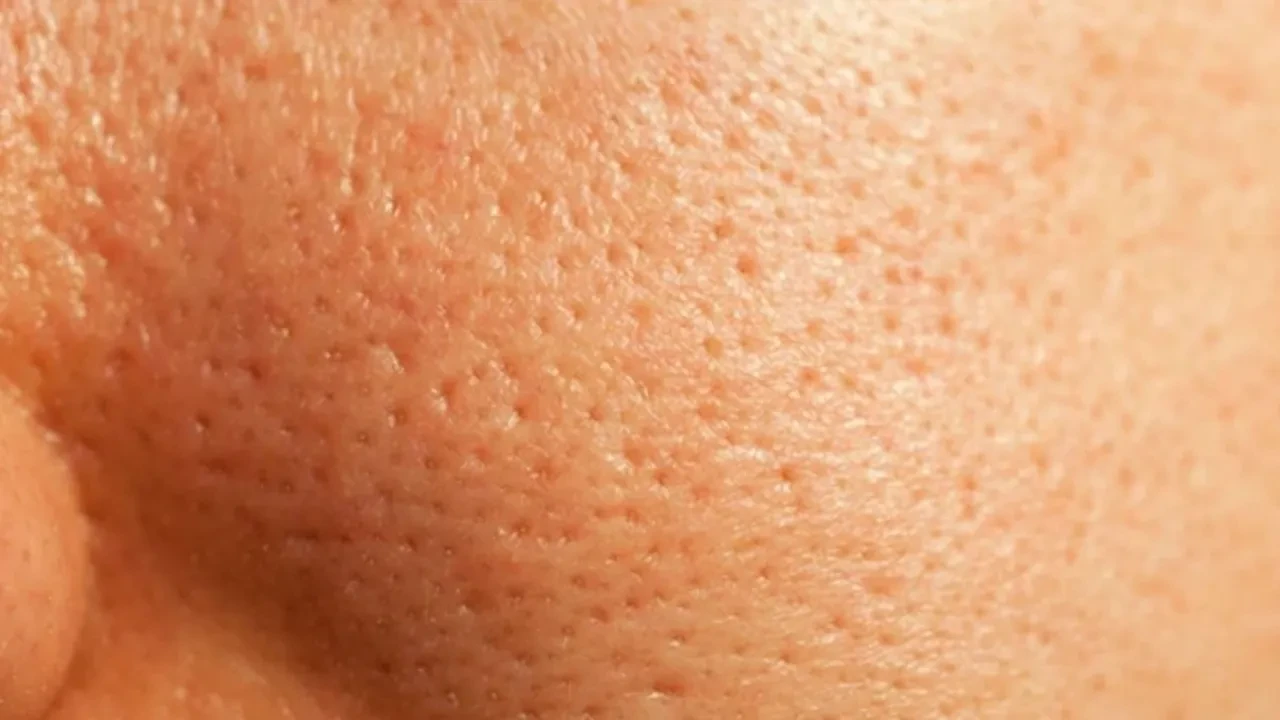 Suna Dumankaya’dan gözenek görünümüne karşı doğal tonik! İşte 4 malzemeli tarif