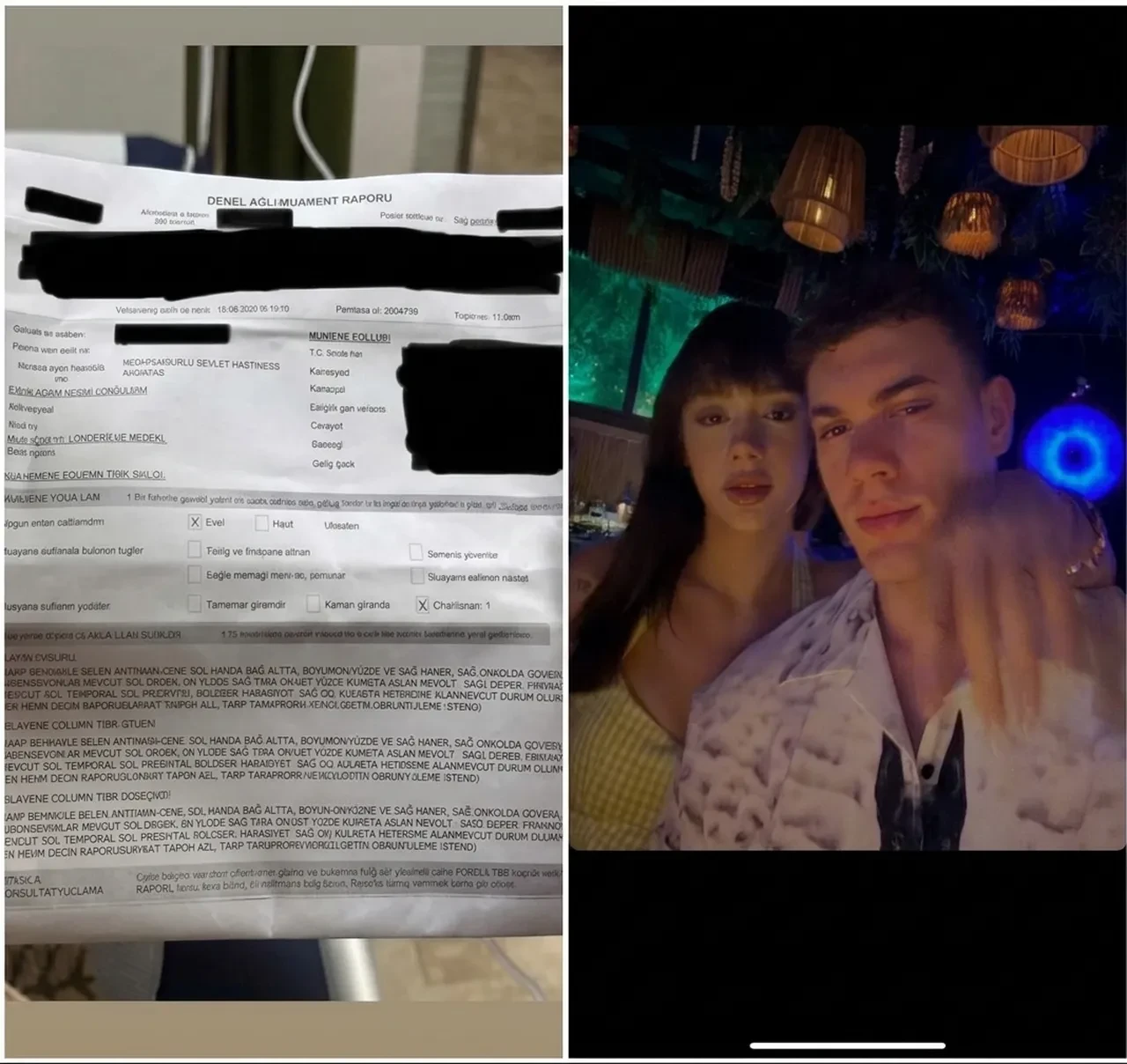 Eftelya Melih Kısmetse Olur olayı nedir? Eftelya Tekçi darp raporunu paylaştı