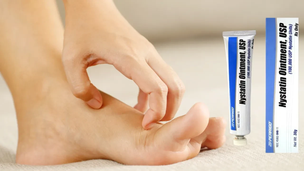 Nistatin krem antibiyotik midir? Nistatin krem ne işe yarar? Nistatin krem kimler kullanır?