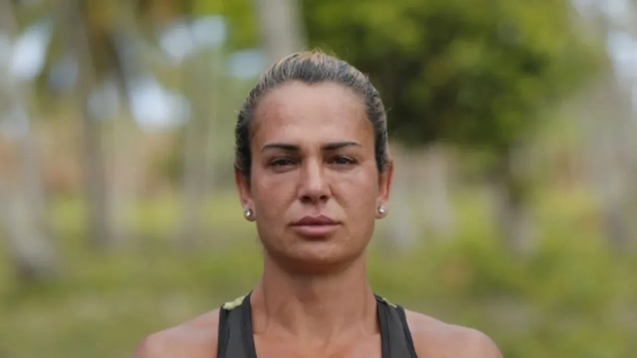 Survivor Nagihan Karadere’nin estetik sonrası son hali ortaya çıktı! “Barbie gibi olacağım” demişti