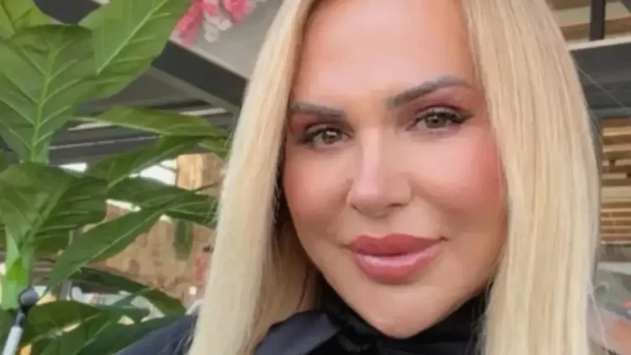 Survivor Nagihan Karadere’nin estetik sonrası son hali ortaya çıktı! “Barbie gibi olacağım” demişti