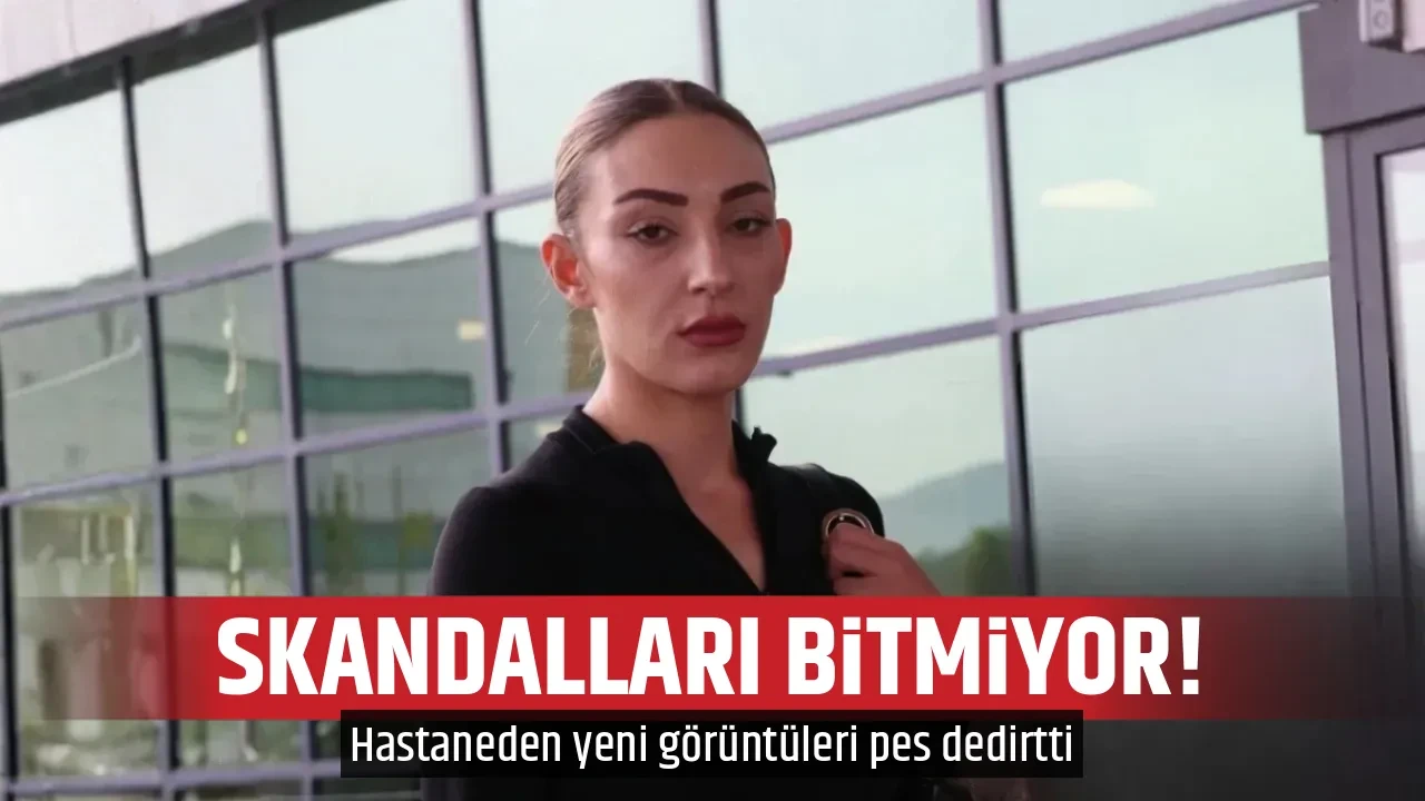 SKANDALLARI BİTMİYOR!