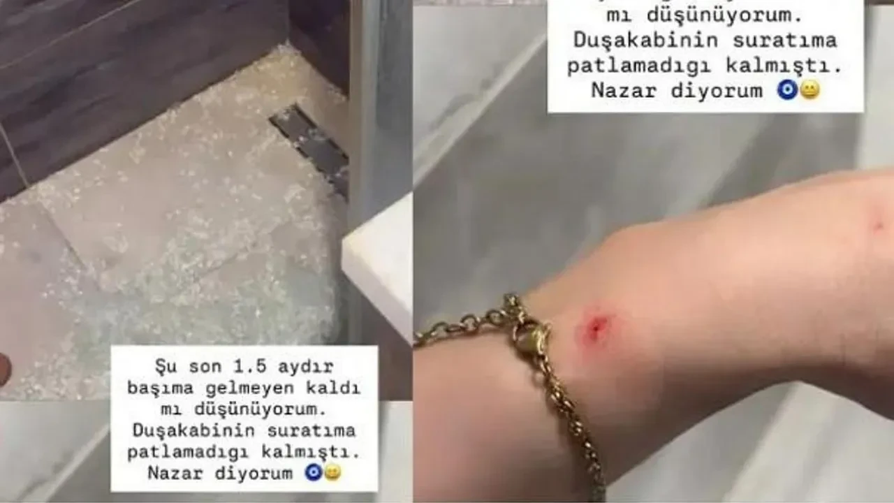 Survivor şampiyonu Nefise Karatay'ın duşakabin camı suratına patladı! Evinde korkutan kaza