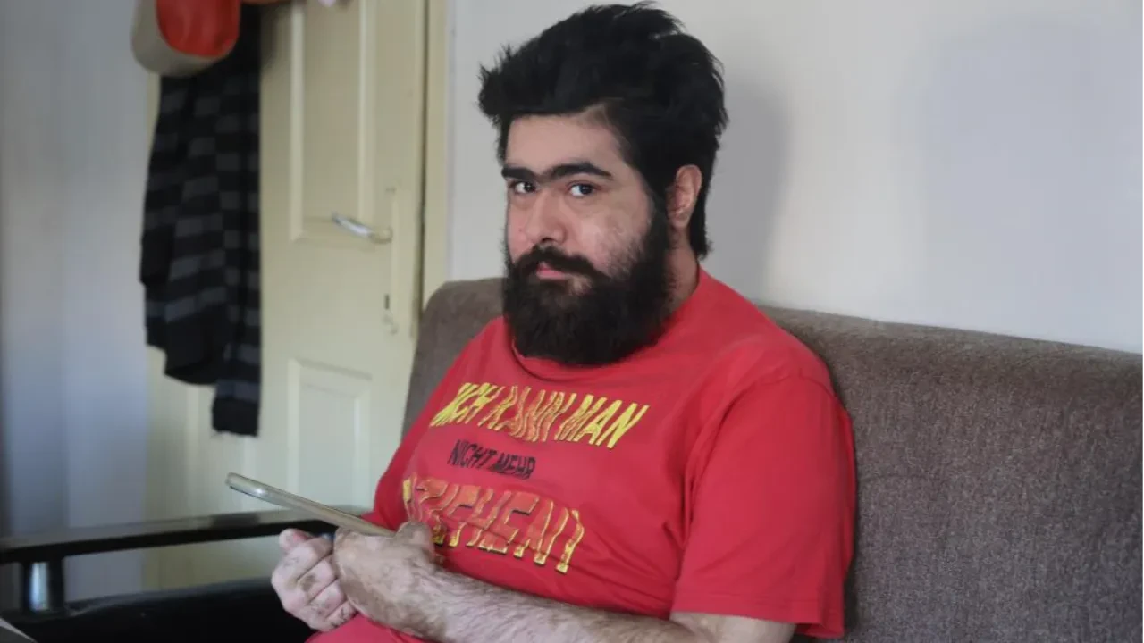 Hatay’da depremin ardından eve kapanan Barış Özbay tedaviyi reddetti: Üzerindeki Almanca yazılı tişörtüyle mesaj verdi