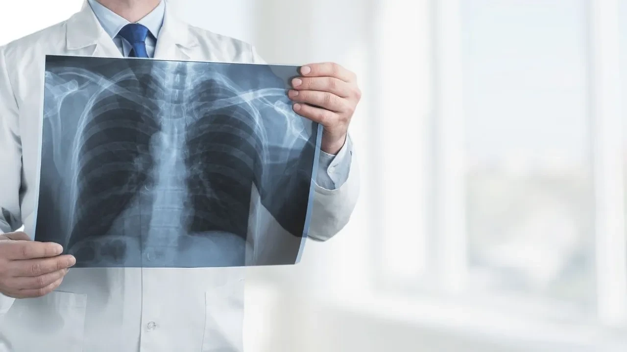 Akut bronşit antibiyotikle geçer mi? Akut bronşit bulaşıcı mı? Akut bronşit ve zatürre arasında fark var mı?