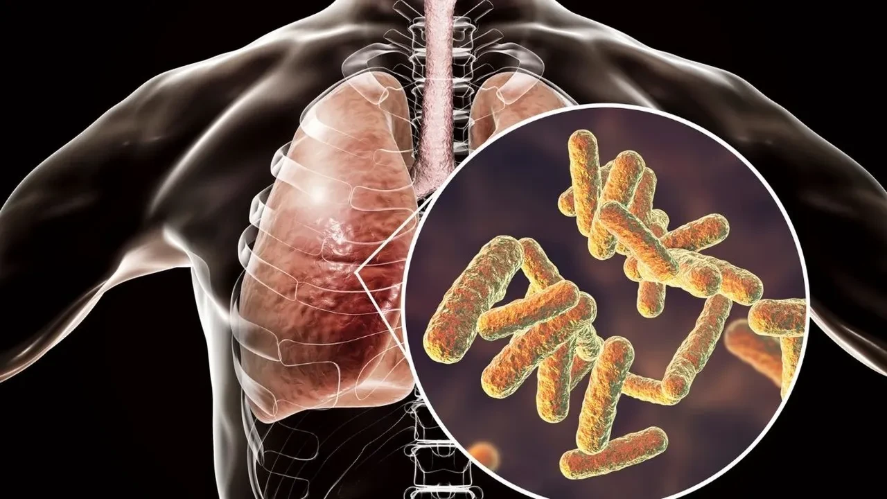Akut bronşit antibiyotikle geçer mi? Akut bronşit bulaşıcı mı? Akut bronşit ve zatürre arasında fark var mı?