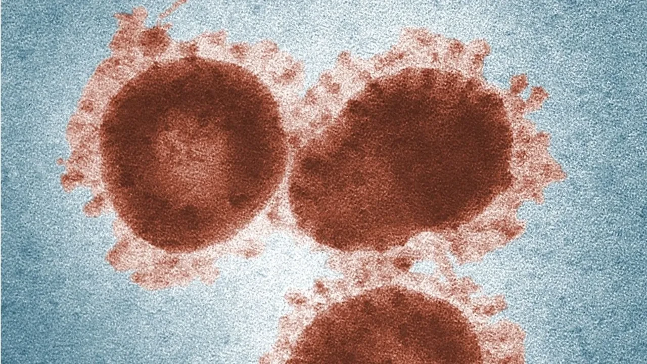 Akut bronşit antibiyotikle geçer mi? Akut bronşit bulaşıcı mı? Akut bronşit ve zatürre arasında fark var mı?