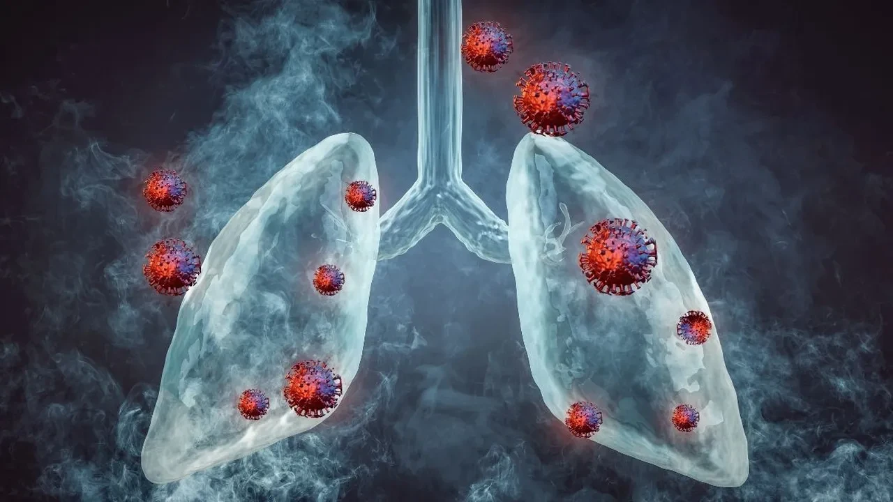 Akut bronşit antibiyotikle geçer mi? Akut bronşit bulaşıcı mı? Akut bronşit ve zatürre arasında fark var mı?