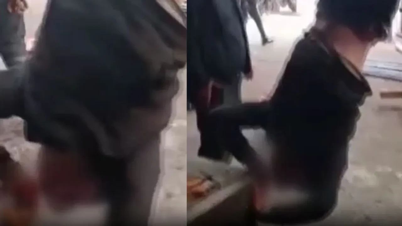 Ankara’da zihinsel engelli çalışanı eğlence olsun diye vince asıp videoya çektiler! 3 şüpheli ve iş yeri sahibi gözaltına alındı