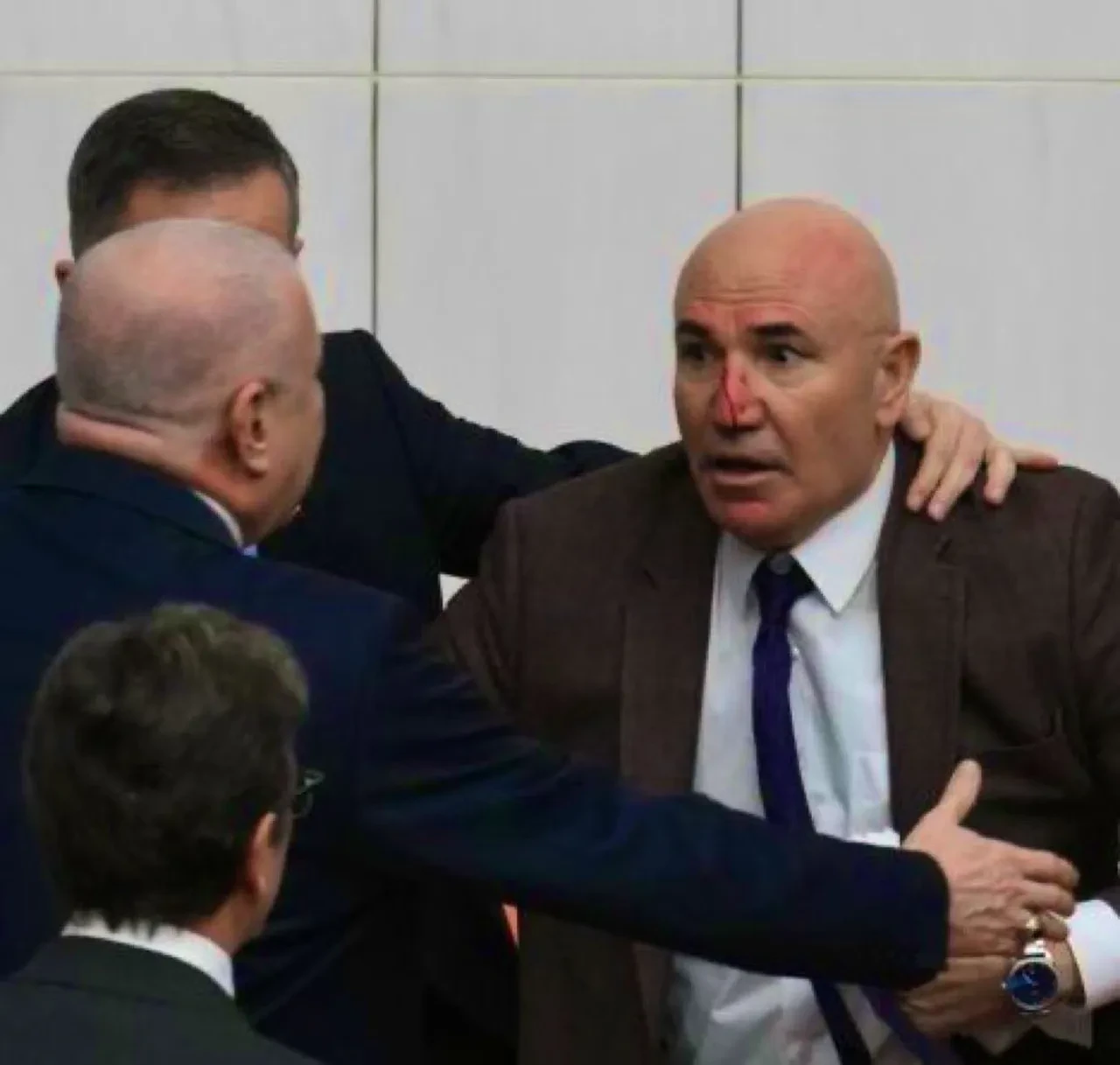 Meclis'te çıkan Akın Gürlek kavgasında CHP'li Mahmut Tanal hastaneye kaldırıldı