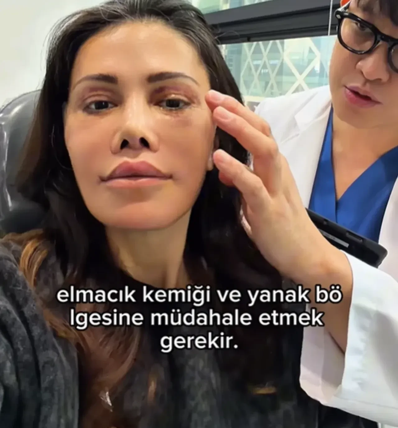 Yüz nakli olan Didem Ceran'dan itiraf üstüne itiraf! "Bugün ilk kez banyo yaptım"