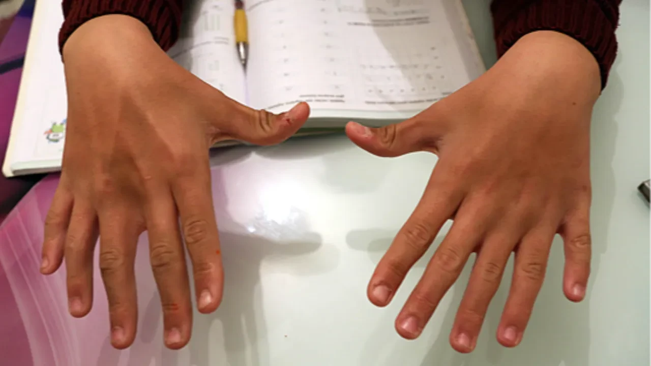 Parmak kütletmek gerçekten kireçlenme yapıyor mu? 60 yıllık deneyin sonuçları herkesi şaşırttı