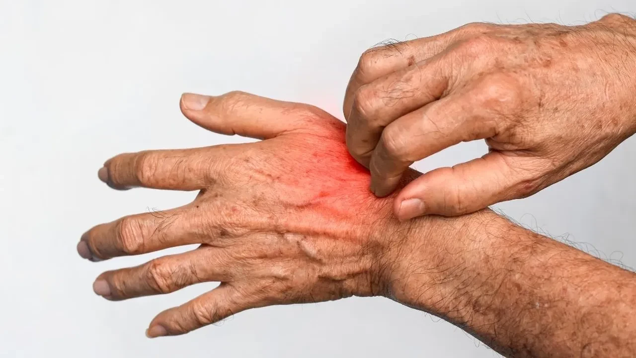 Alerjik vücutlar için İbn-i Sina’dan şifa karışımı! Cilt rahatsızlıklarına son