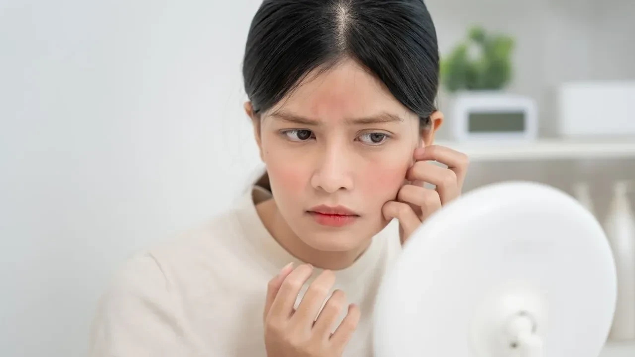 Alerjik vücutlar için İbn-i Sina’dan şifa karışımı! Cilt rahatsızlıklarına son