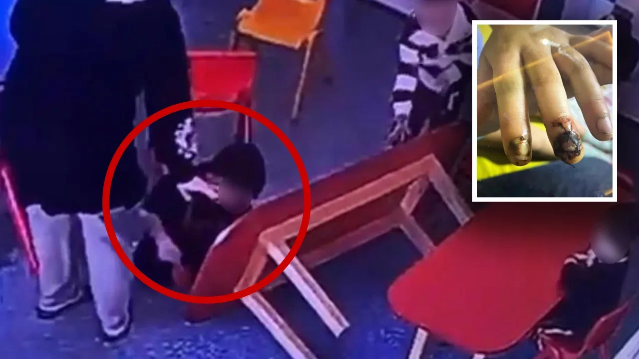 Özel okulda dehşet! Masa küçük çocuğun üzerine devrildi: Parmakları bu hale geldi 