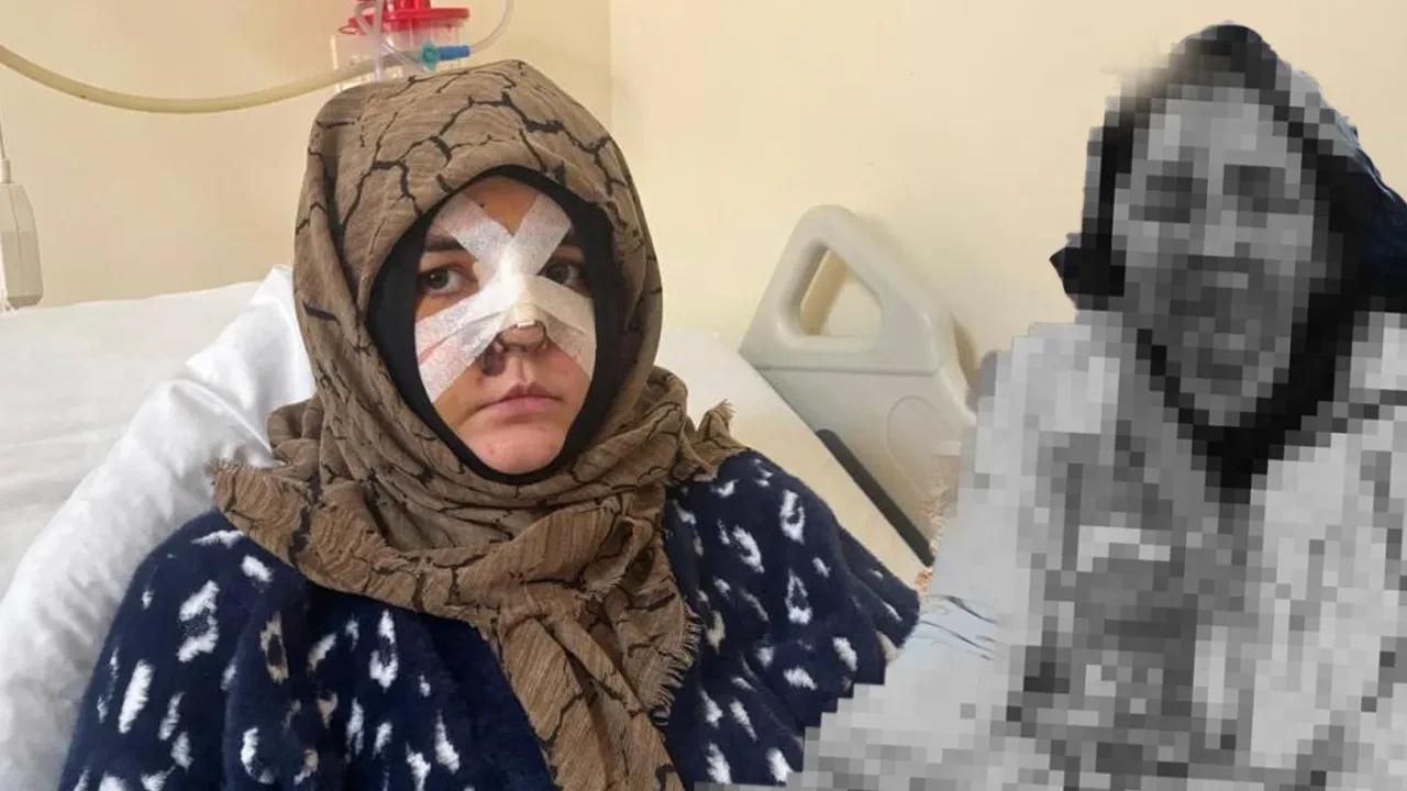 Kocasının öldüresiye darbettiği kadının sözleri dehşete düşürdü: Taşla suratıma defalarca vurdu