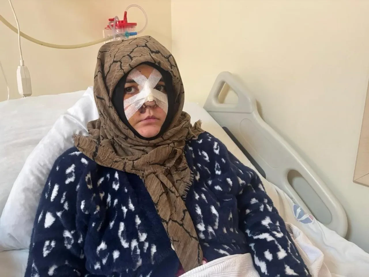 Kocasının öldüresiye darbettiği kadının sözleri dehşete düşürdü: Taşla suratıma defalarca vurdu