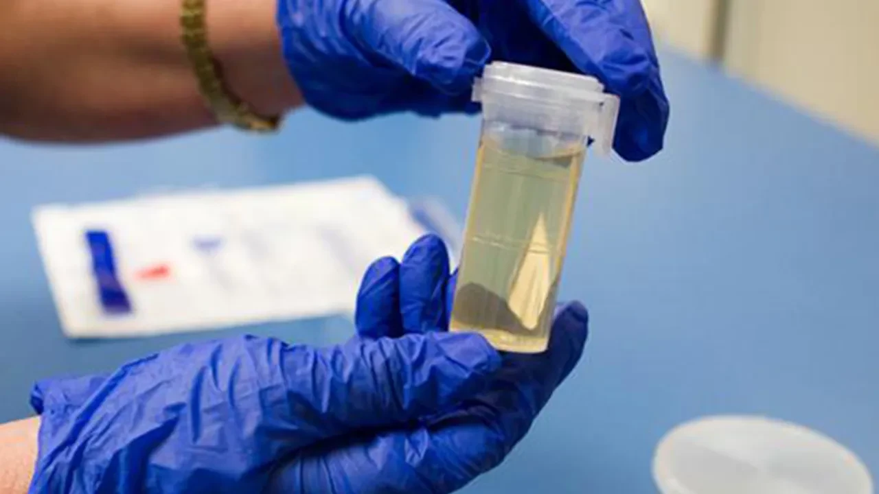 İş başvurusunda 'madde testi' dönemi! İşverenler şart koşuyor: Fiyatı 2.200 TL 