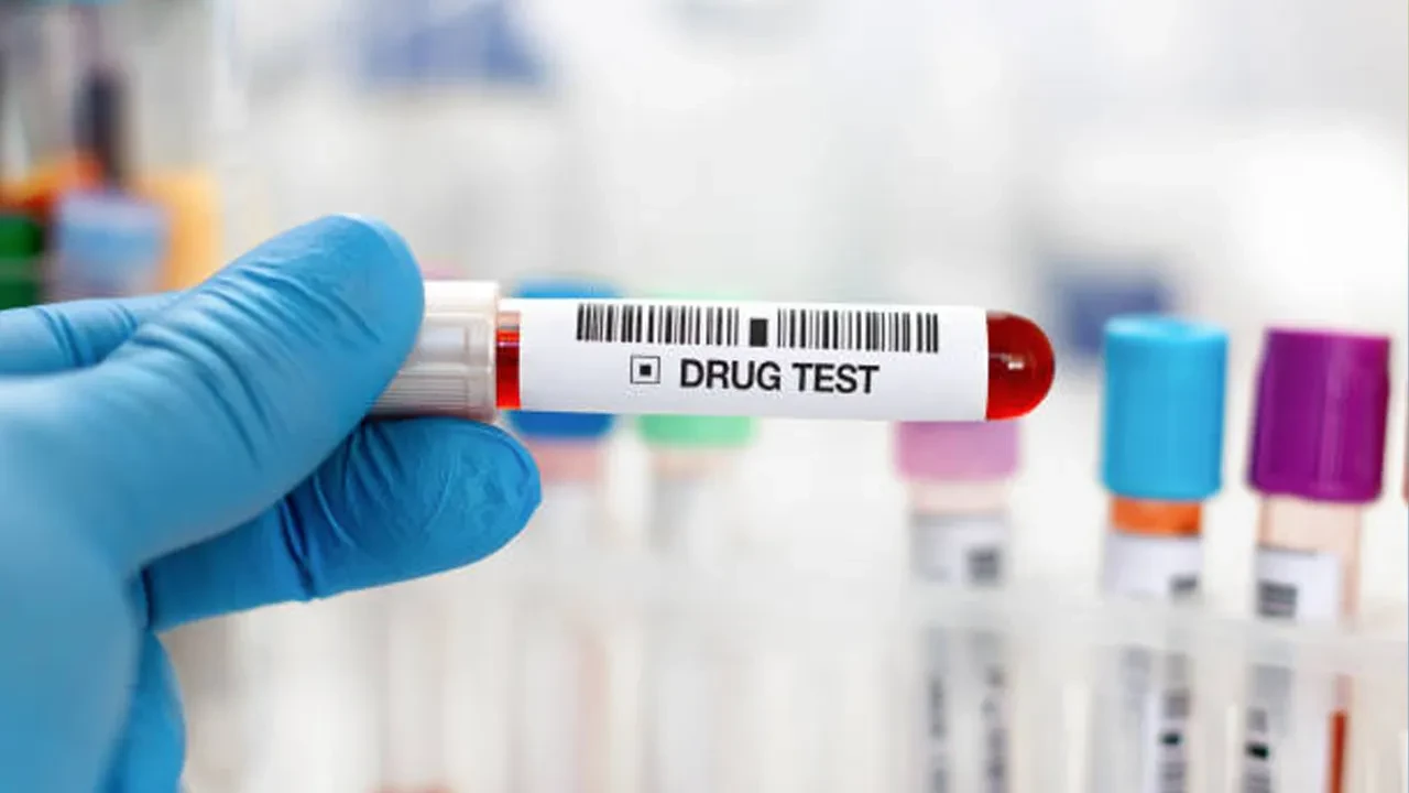 İş başvurusunda 'madde testi' dönemi! İşverenler şart koşuyor: Fiyatı 2.200 TL 